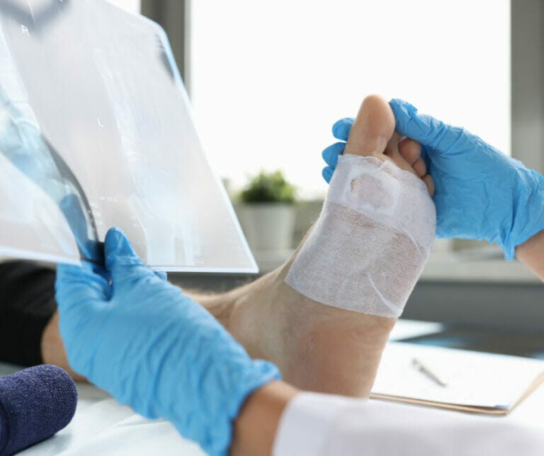 Skin: Wounds: Diabetic Foot Ulcers - 26 Foot & Ankle