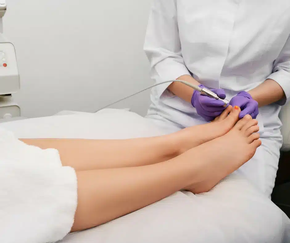Laser Therapy: Toenail Fungus 2 Laser therapy being applied to a patient's toenail to treat fungal infection.