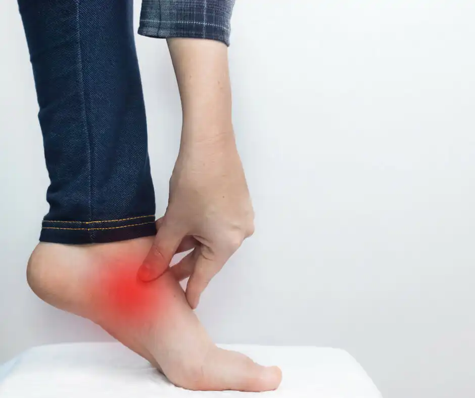 Fallen Arch: Tibialis Posterior Tendon Dysfunction 2 Fallen Arch: Tibialis Posterior Tendon Dysfunction - Medical illustration showing the tibialis posterior tendon and its role in supporting the foot arch.