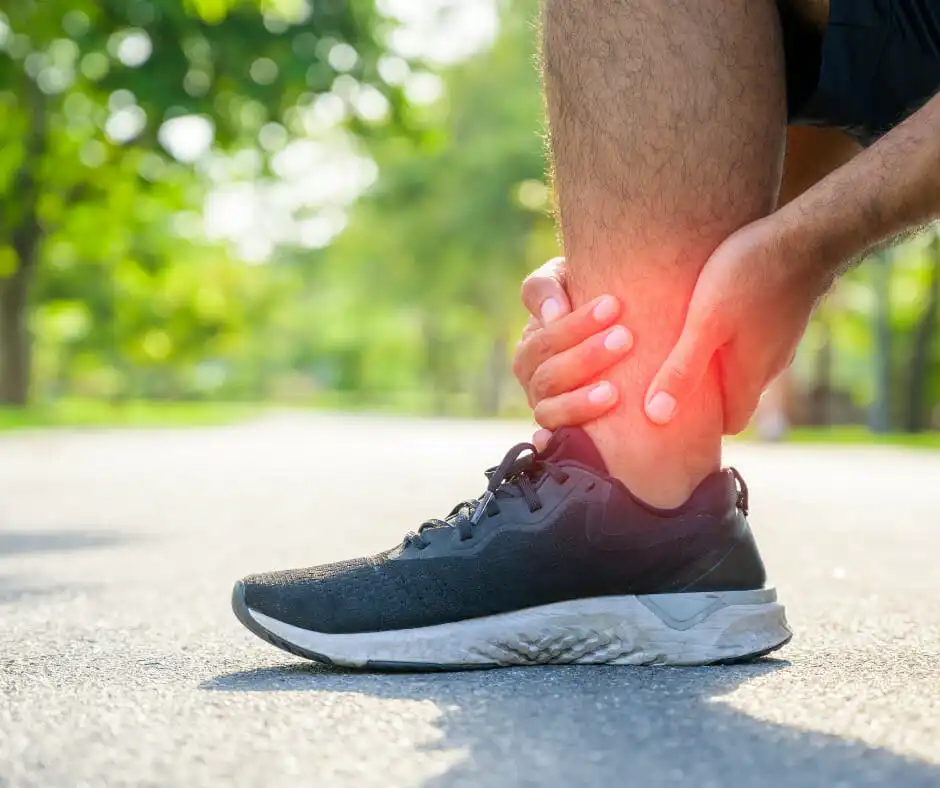 Ankle Sprain: Common Ankle Sprain 2 Ankle Sprain - Severe lateral ankle sprain with swelling and bruising.