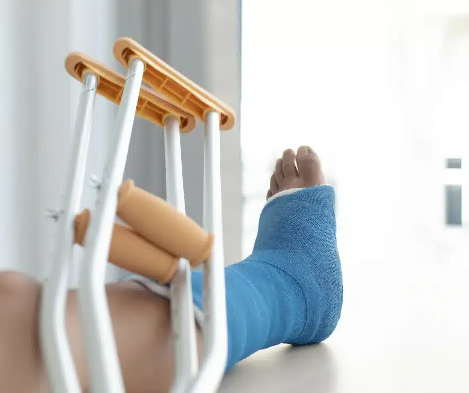 Fracture Repair: Ankle - Diagram illustrating the anatomy of the ankle joint, highlighting common fracture sites.