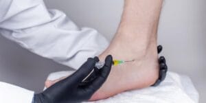 prp injection conservative treatment for achilles tendonitis