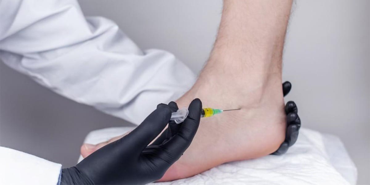 Conservative Treatment for Achilles Tendonitis: PRP Injections