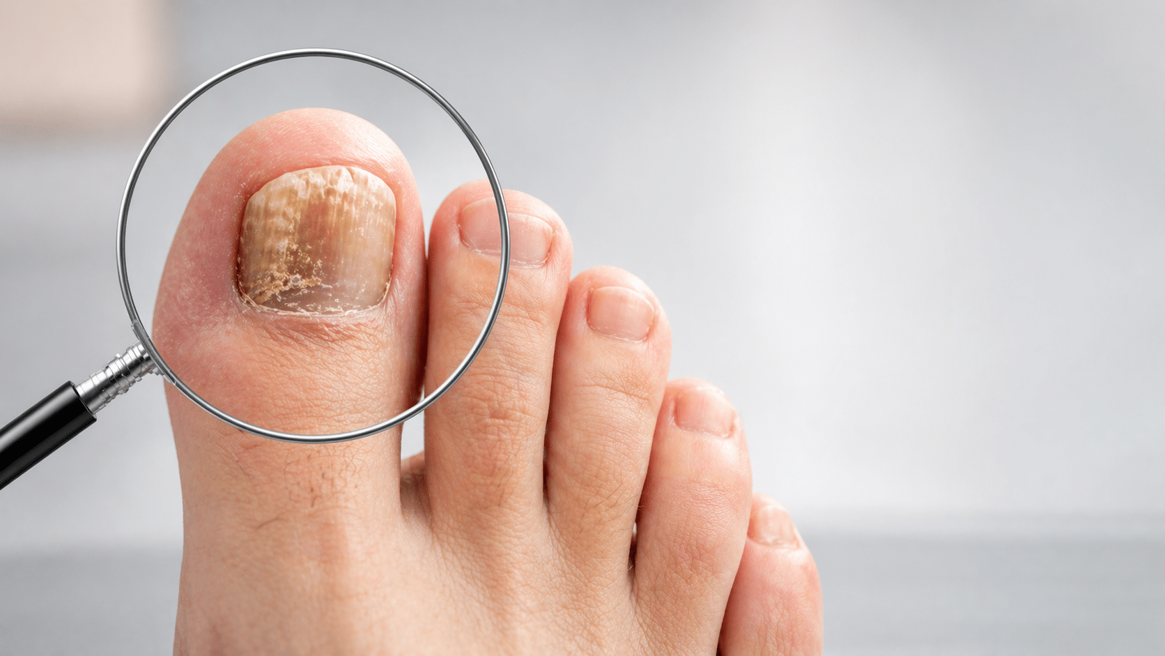 toenail problems